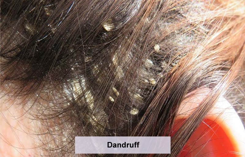 Treatment photo 1