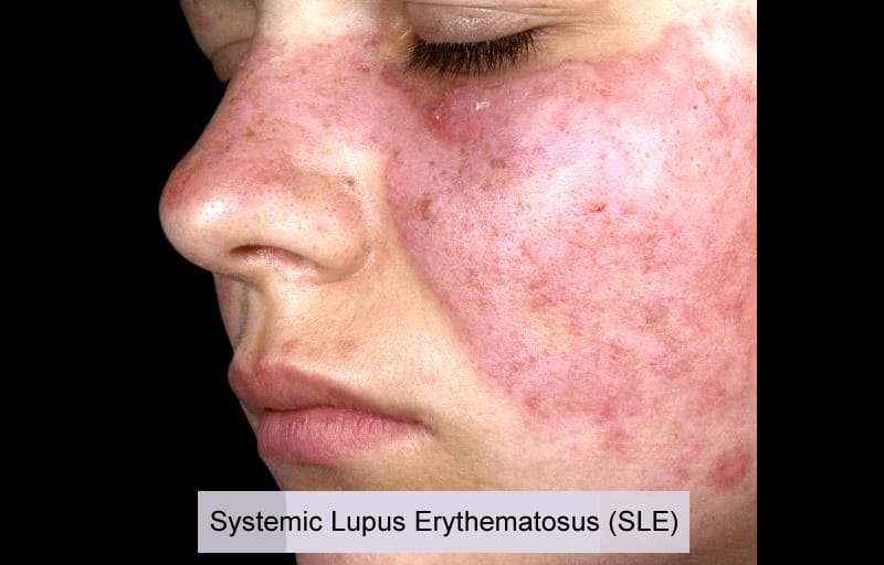 Treatment photo 14