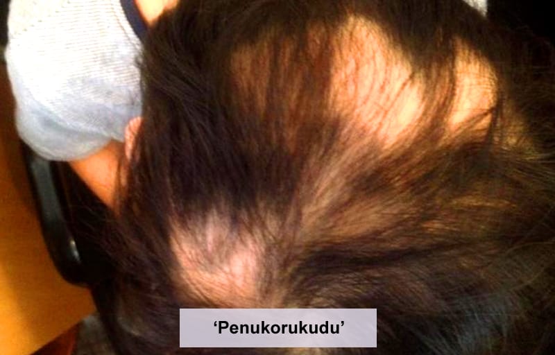 Treatment photo 4