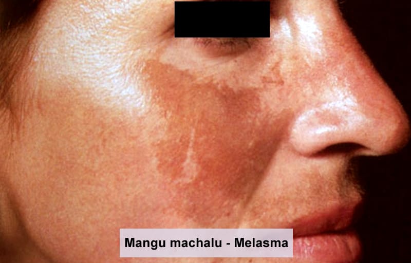 Treatment photo 9
